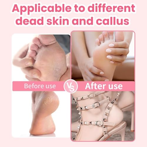 Electric Foot Callus Remover